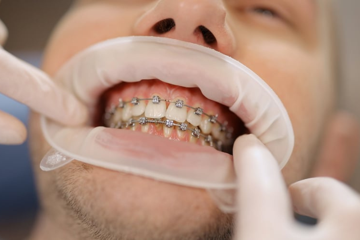 https://skarradental.com/wp-content/uploads/2024/04/Untitled-design-63.png